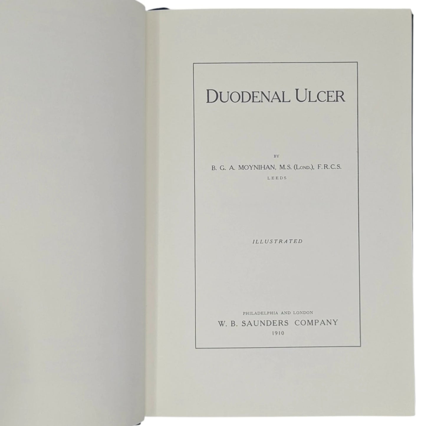 Duodenal Ulcer