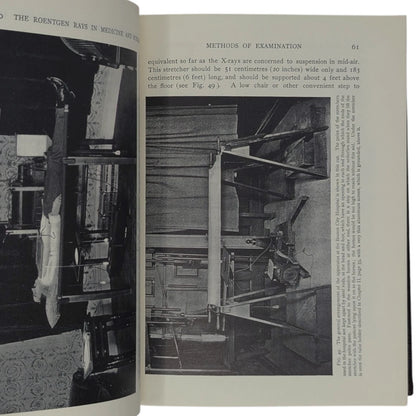 The Roentgen Rays in Medicine and Surgery