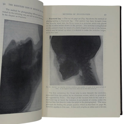 The Roentgen Rays in Medicine and Surgery
