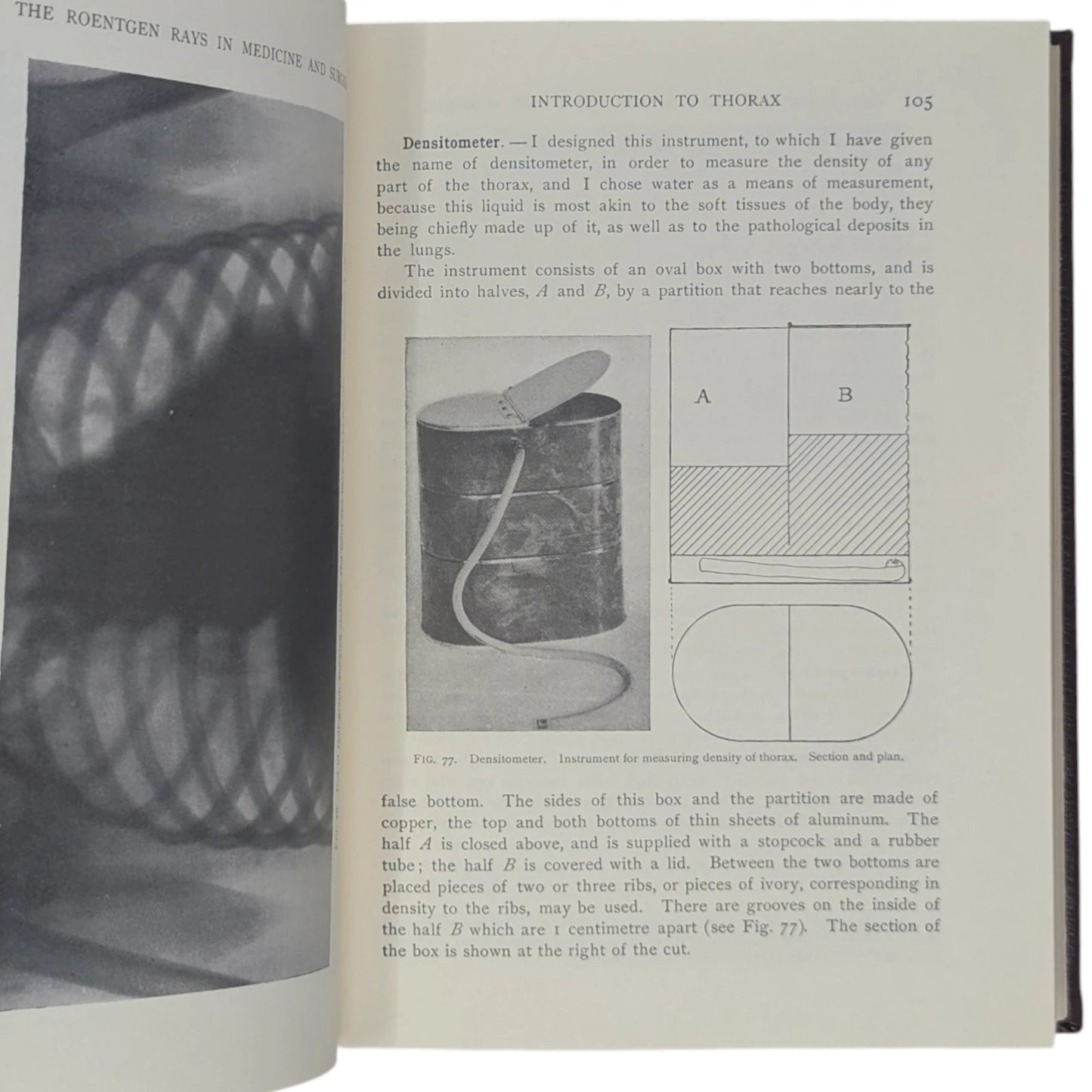 The Roentgen Rays in Medicine and Surgery