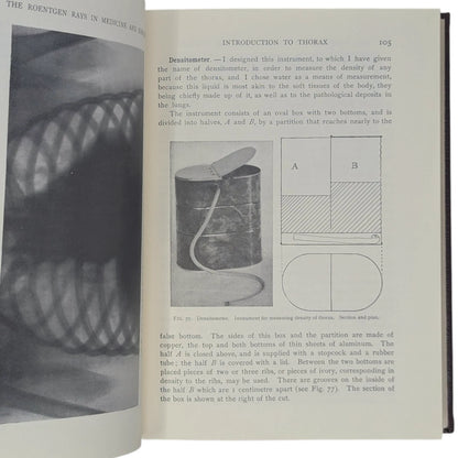 The Roentgen Rays in Medicine and Surgery
