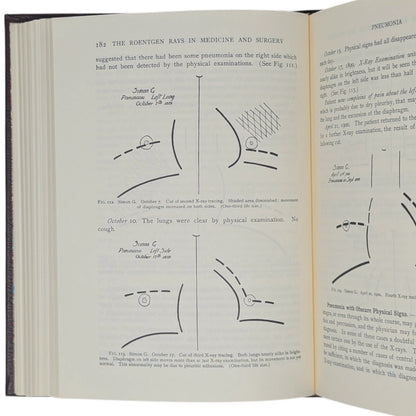 The Roentgen Rays in Medicine and Surgery